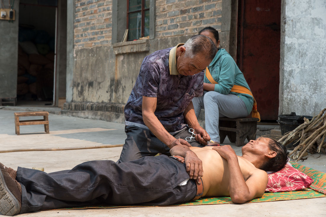 Chinese shaman from the La Hu ethnic minority people, performing acupunture. Lao Ba Dao village, Lan Cang County, Yunnan Province, China, Asia. Nikon D4, 24-120mm, f/4.0, VR