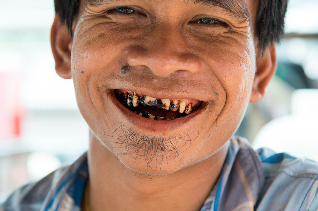 Young man making a big smile and showing his stained teeth because of his addiction of chewing paan (lime, tobacco, areca nuts and betel leaves). Yangon, Myanmar, Indochina, South East Asia