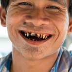 Young man making a big smile and showing his stained teeth because of his addiction of chewing paan (lime, tobacco, areca nuts and betel leaves). Yangon, Myanmar, Indochina, South East Asia